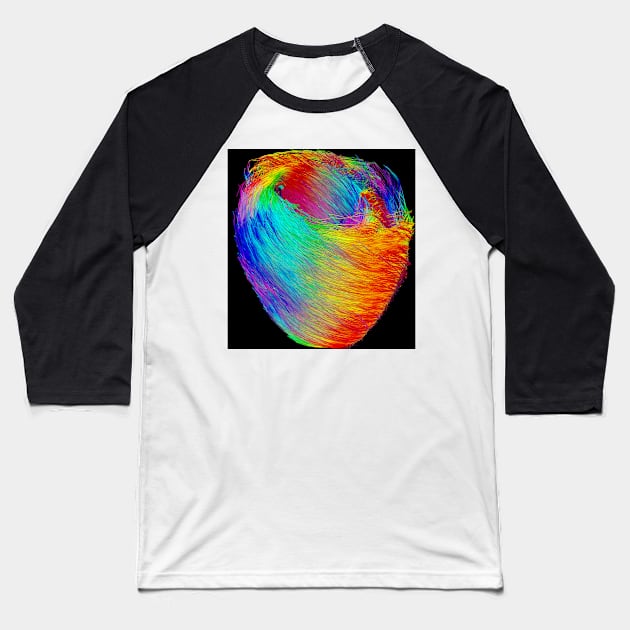 Heart muscle fibres, DTI scan (C021/5126) Baseball T-Shirt by SciencePhoto